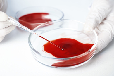 Scientist taking blood sample from Petri dish with pipette in laboratory, closeup. Virus research