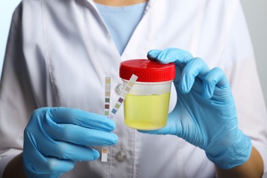 Doctor holding container with urine sample and test strips for analysis, closeup