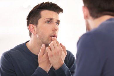 Young man applying cold sore cream on lips in front of mirror