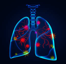 Illustration of human lungs affected with disease on dark background