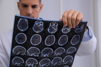 Doctor examining MRI images of patient with multiple sclerosis in clinic, closeup