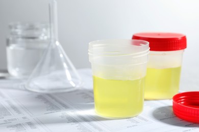 Containers with urine samples for analysis and glassware on test forms in laboratory