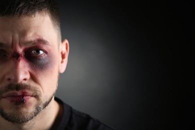 Closeup view of man with facial injuries on dark background, space for text. Domestic violence victim