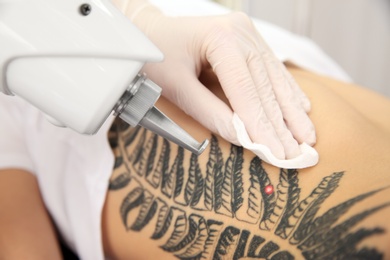 Young woman undergoing laser tattoo removal procedure, closeup