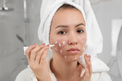 Photo of Teen girl with acne problem applying cream in bathroom