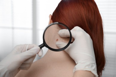 Dermatologist examining patient's birthmark with magnifying glass in clinic, closeup view