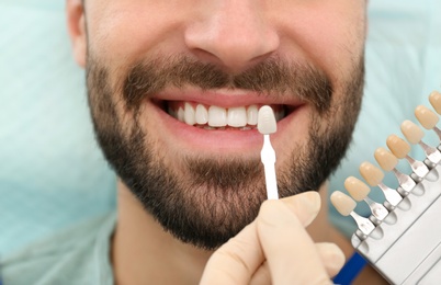 Dentist matching young man's teeth color with palette, closeup