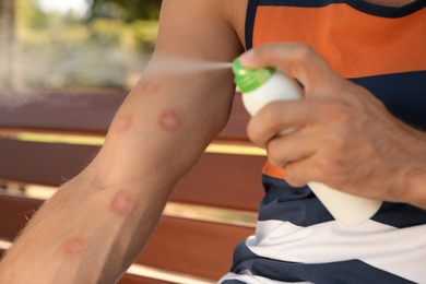 Man spraying insect repellent on his arm outdoors, closeup