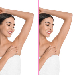 Collage of woman showing armpit before and after epilation on white background