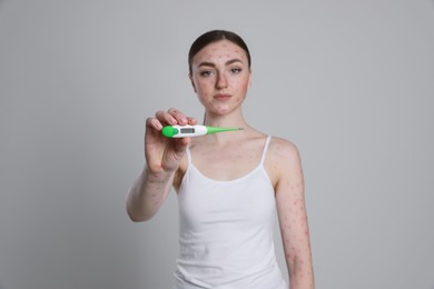 Photo of Woman with rash holding thermometer on light grey background. Monkeypox virus