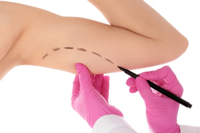 Doctor drawing marks on woman's arm against white background. Cosmetic surgery