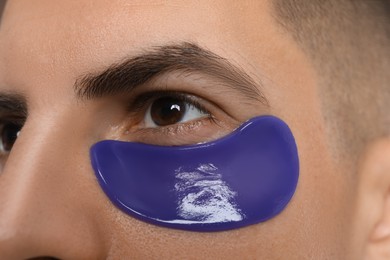 Man with blue under eye patch, closeup