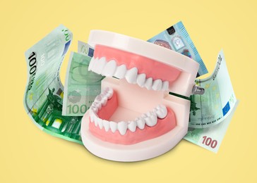 Model of oral cavity with teeth and euro banknotes on yellow background. Concept of expensive dental procedures