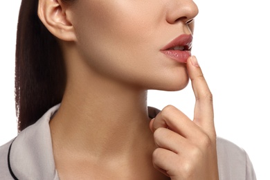 Woman with herpes touching lips on white background, closeup