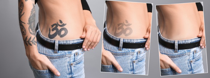 Woman before and after laser tattoo removal procedures on grey background, closeup. Collage with photos, banner design