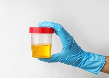 Laboratory worker holding jar with urine sample on light background. Urology concept