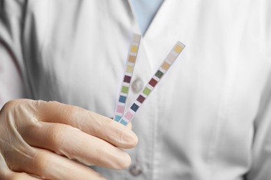 Doctor holding urine test strips, closeup view