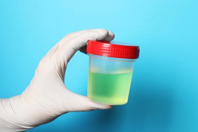 Doctor wearing glove holding container with urine sample for analysis on light blue background, closeup