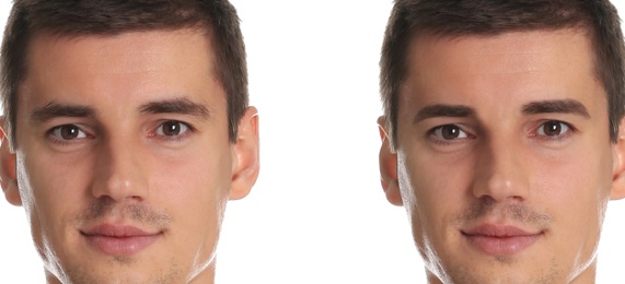 Man before and after eyebrow modeling on white background, collage. Banner design