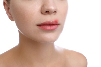 Young woman with cold sore on lips against white background, closeup
