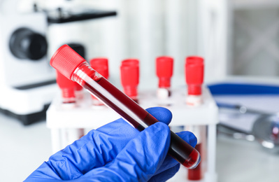 Scientist holding test tube with blood sample at table, closeup. Virus research
