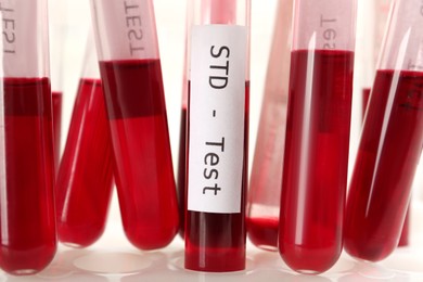 Tubes with blood samples in rack on white background, closeup. STD test