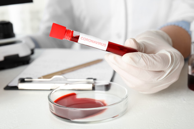 Scientist holding test tube with blood sample and label CORONA VIRUS in laboratory, closeup