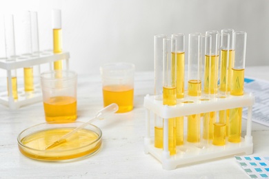 Urine samples in laboratory glassware on table. Urology concept