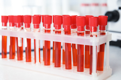Test tubes with blood samples on table in laboratory, closeup. Virus research