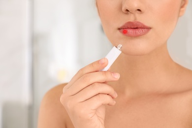 Woman with herpes applying cream onto lip against blurred background, closeup