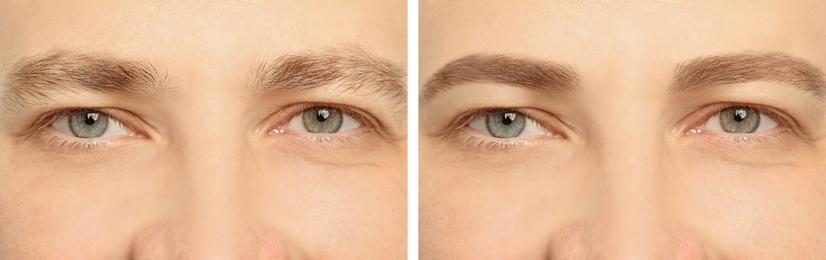 Collage with photos of man before and after eyebrow modeling, closeup. Banner design