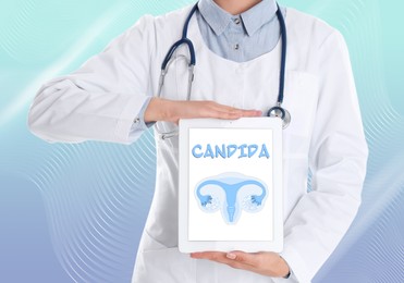 Doctor holding modern tablet with word Candida and illustration of female reproductive system on light blue background, closeup
