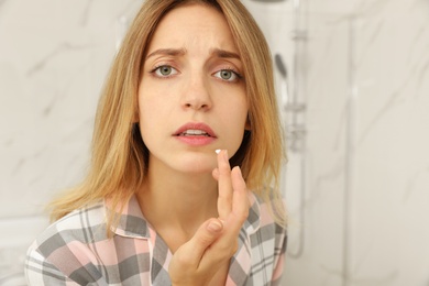 Photo of Woman with herpes applying cream onto lip in bathroom