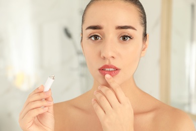 Photo of Woman with herpes applying cream on lips against blurred background