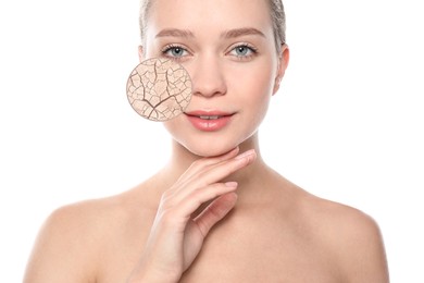 Young woman with facial dry skin problem on white background