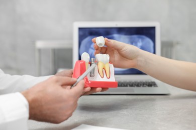Photo of Doctor showing patient educational model of dental implant in clinic, closeup