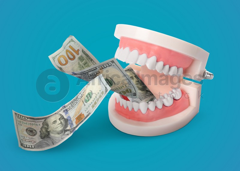 Model of oral cavity with teeth and dollar banknotes on turquoise background. Concept of expensive dental procedures