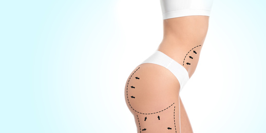 Slim young woman with marks on body for cosmetic surgery operation against light background, closeup. Banner design