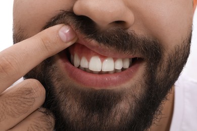 Young man showing white teeth, closeup view
