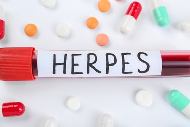 Test tube with word Herpes and different pills on white background, closeup