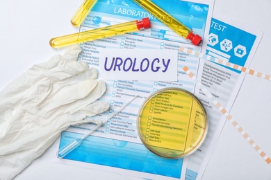 Flat lay composition with test forms and urine samples on light background. Urology concept