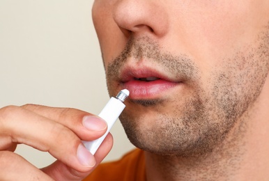 Young man with cold sore applying cream on lips against light background, closeup
