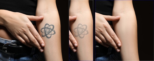 Woman before and after laser tattoo removal procedures on black background, closeup. Collage with photos, banner design