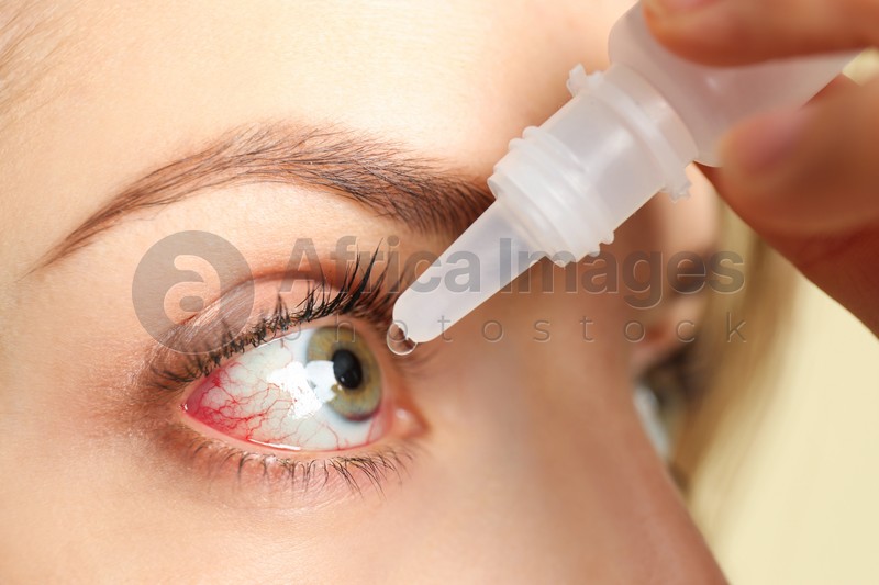 Woman using eye drops on light background, closeup