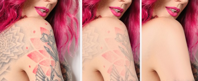 Woman before and after laser tattoo removal procedures, closeup. Collage with photos, banner design