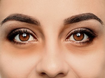 Tired young woman with dark circles under eyes, closeup