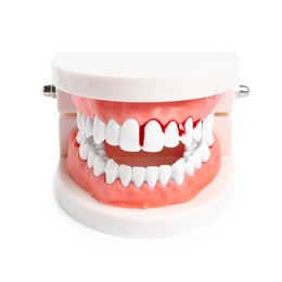 Model of jaw with blood on teeth against white background. Gum problems