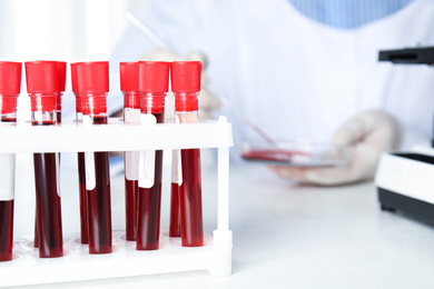 Test tubes with blood samples on table in laboratory. Virus research