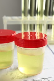 Containers with urine sample for analysis on test form in laboratory