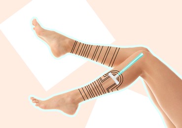 Epilation concept. Young woman showing beautiful legs with lines and razor on beige background, closeup